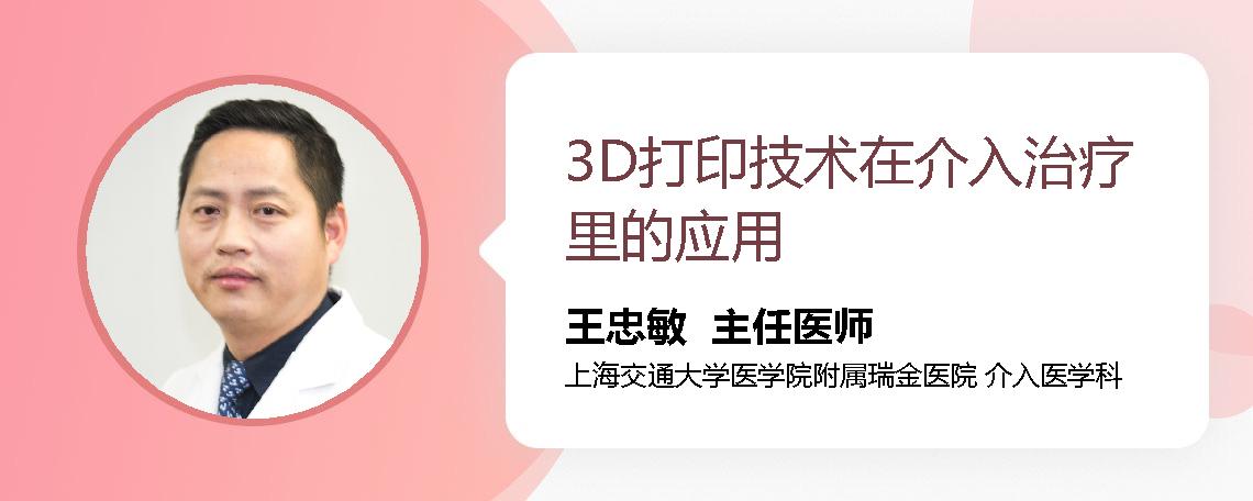3D打印技术在介入治疗里的应用