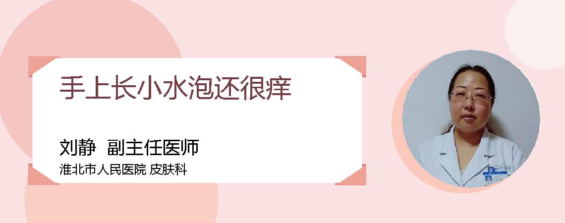 手上长小水泡还很痒