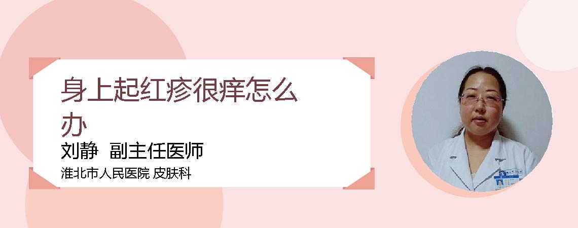 身上起红疹很痒怎么办