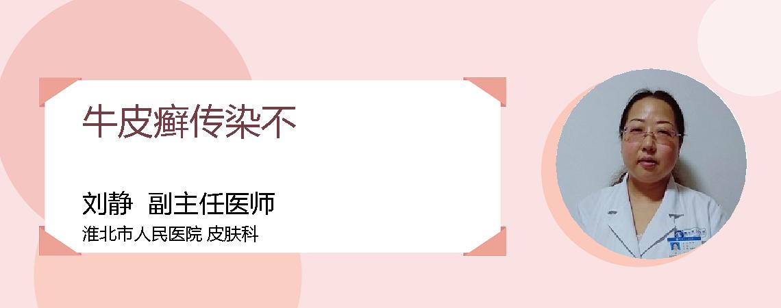 牛皮癣传染不