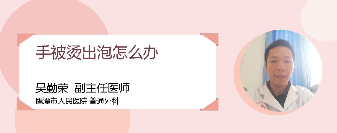 手被烫出泡怎么办