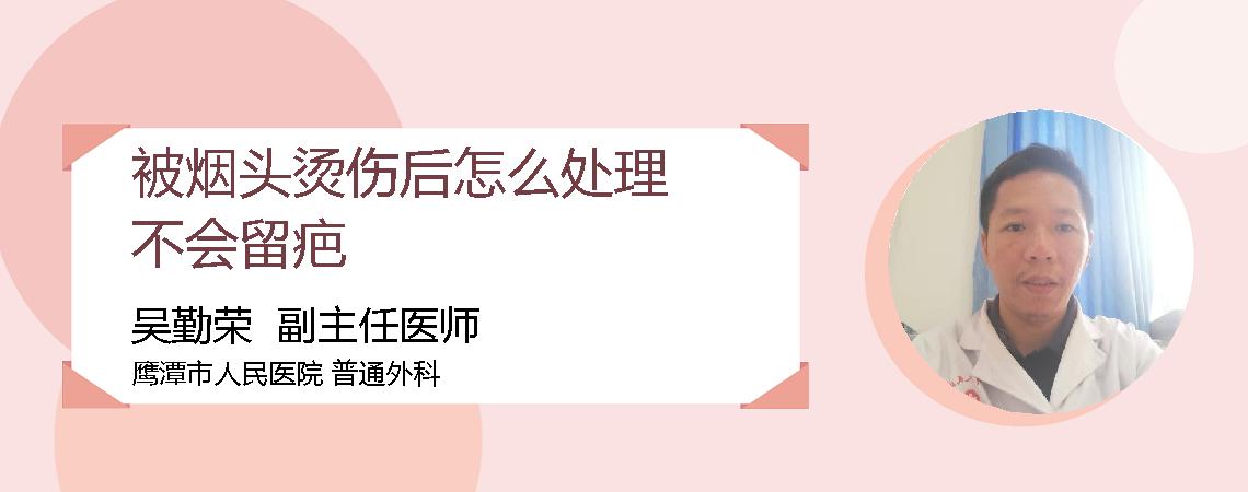 被烟头烫伤后怎么处理不会留疤