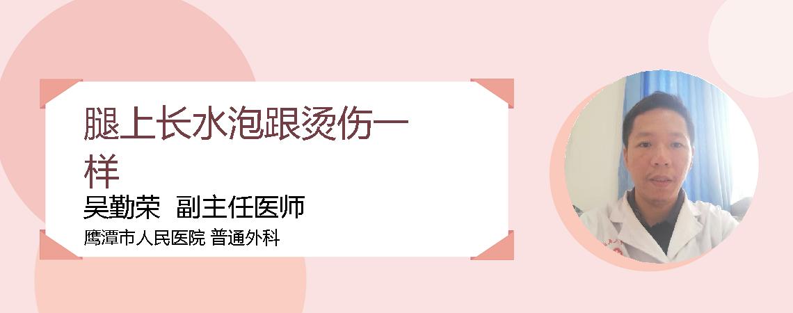 腿上长水泡跟烫伤一样