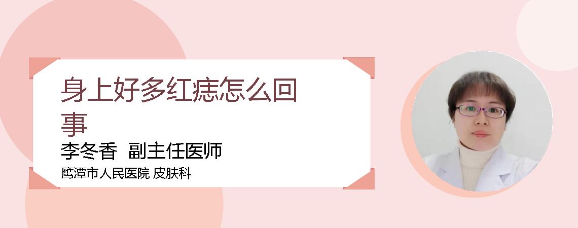 身上好多红痣怎么回事