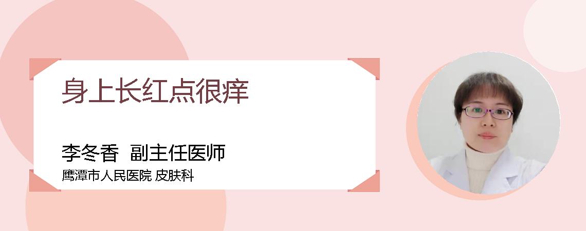 身上长红点很痒