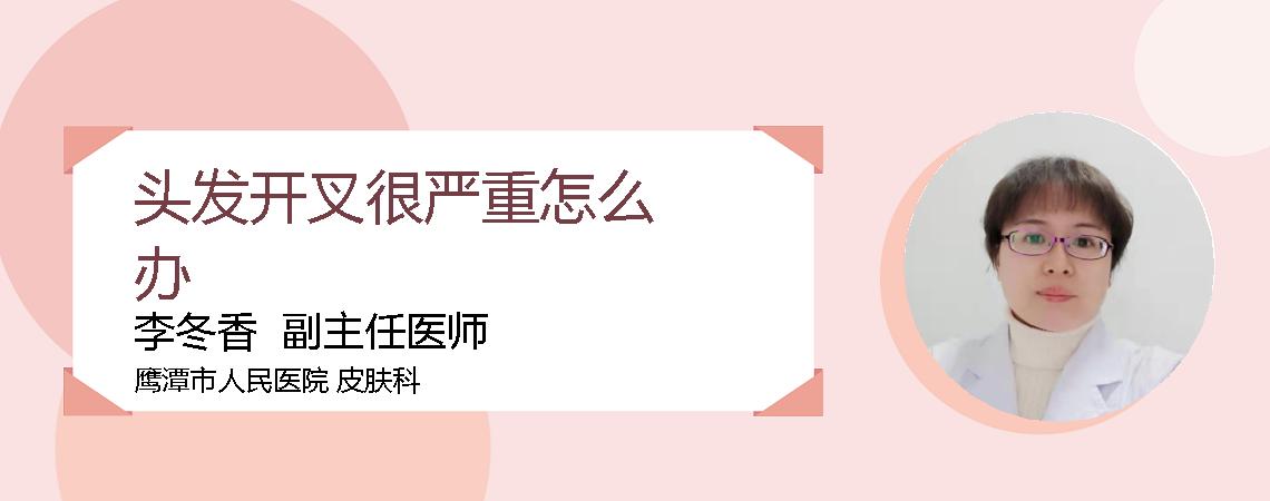 头发开叉很严重怎么办