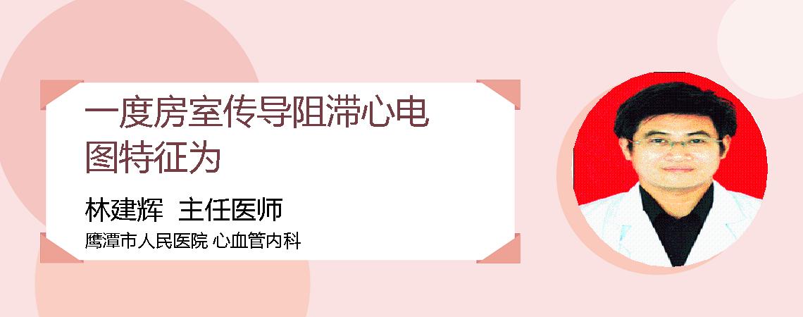 一度房室传导阻滞心电图特征为