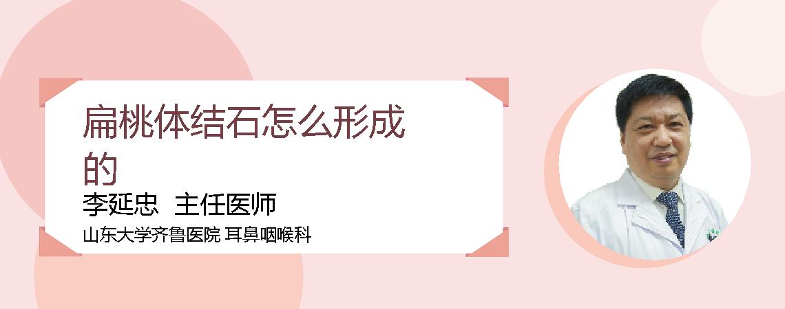扁桃体结石怎么形成的