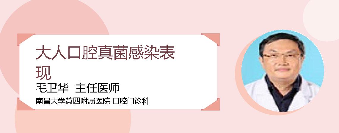 大人口腔真菌感染表现