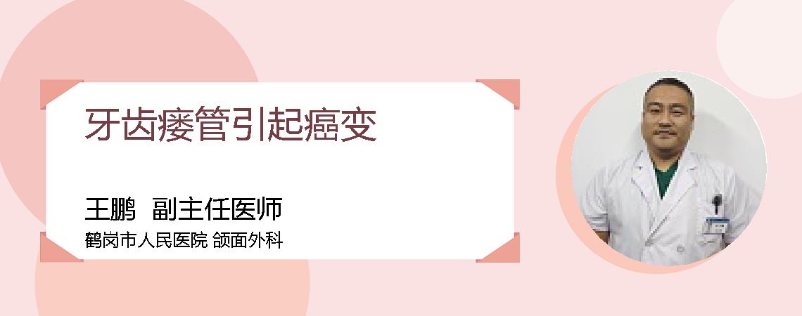 牙齿瘘管引起癌变