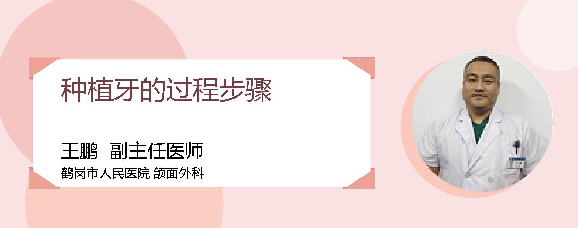 种植牙的过程步骤