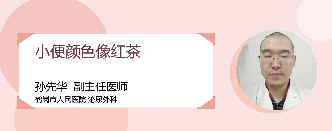小便颜色像红茶