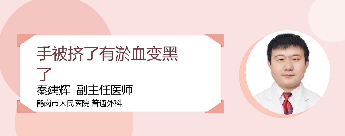 手被挤了有淤血变黑了