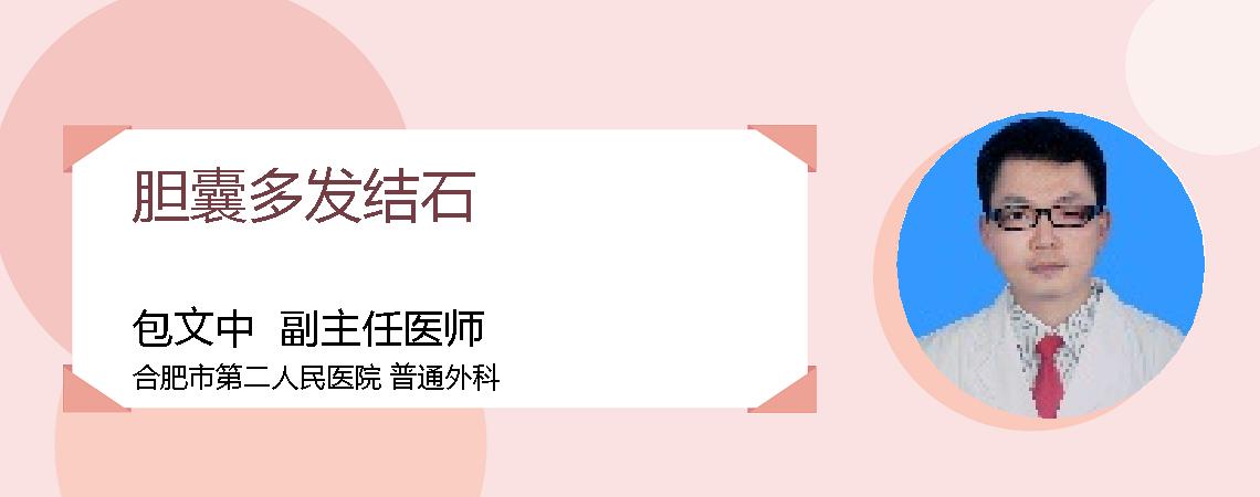 胆囊多发结石