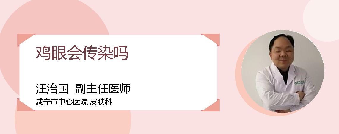 鸡眼会传染吗