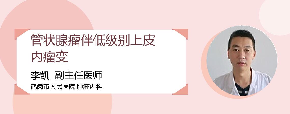 管状腺瘤伴低级别上皮内瘤变