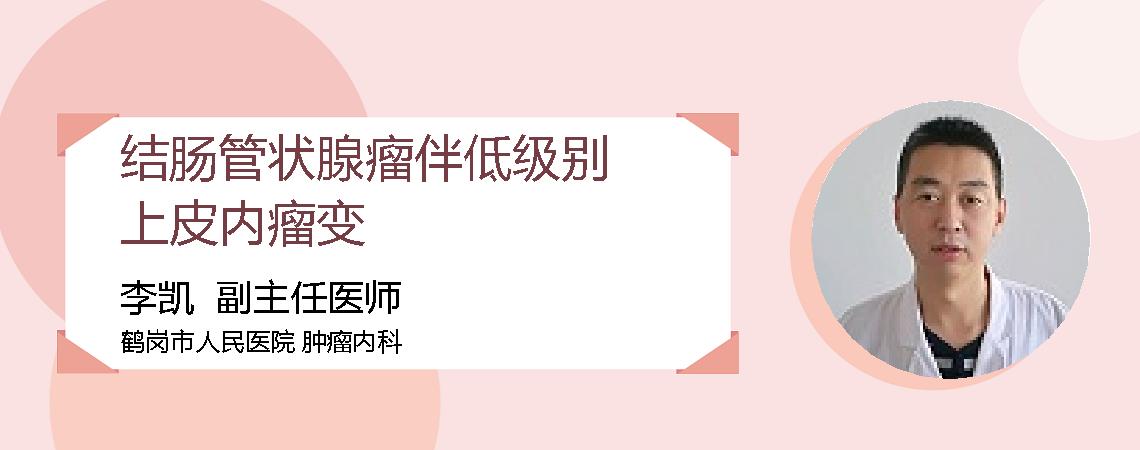 结肠管状腺瘤伴低级别上皮内瘤变