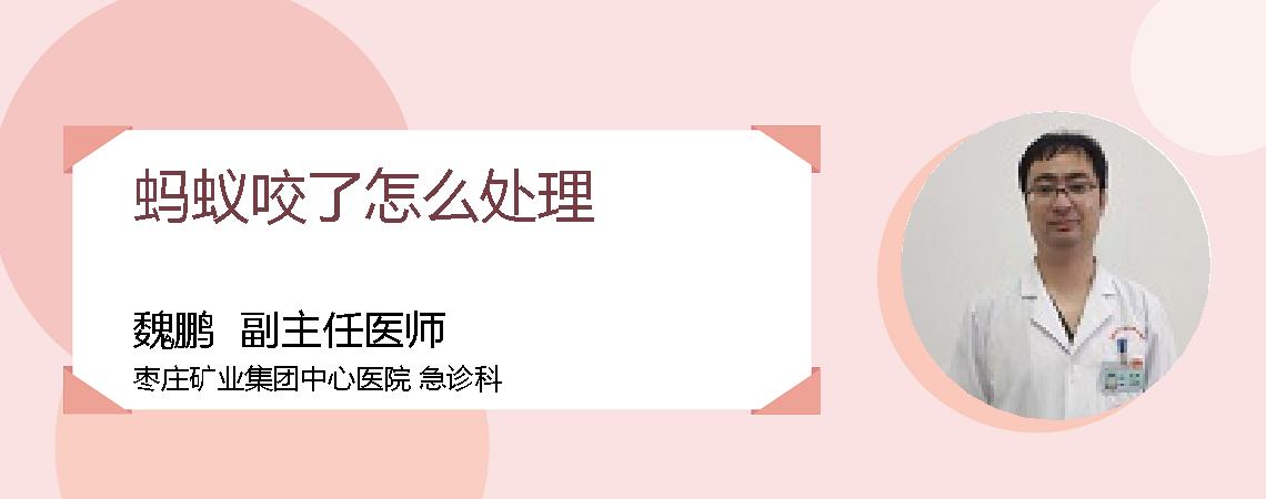 蚂蚁咬了怎么处理