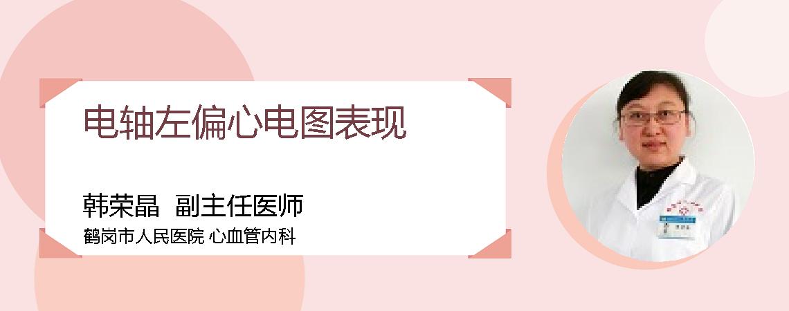 电轴左偏心电图表现
