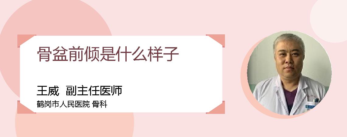骨盆前倾是什么样子