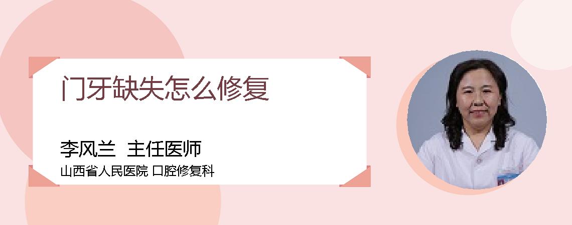 门牙缺失怎么修复