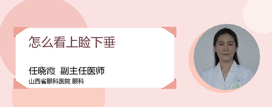 怎么看上睑下垂