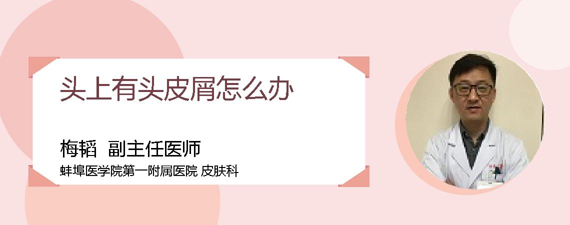 头上有头皮屑怎么办