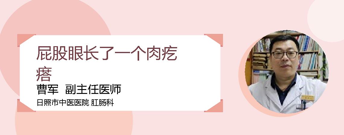 屁股眼长了一个肉疙瘩