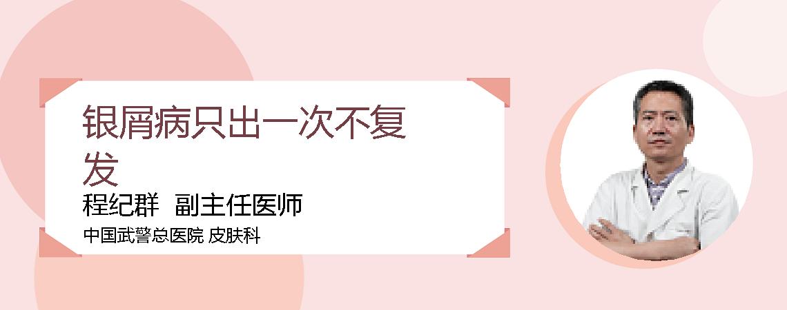 银屑病只出一次不复发
