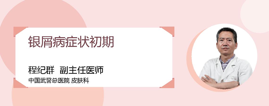 银屑病症状初期