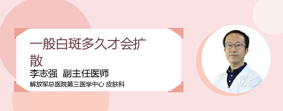一般白斑多久才会扩散