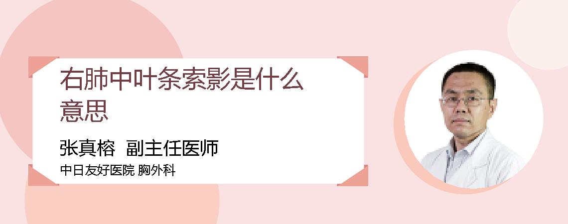 右肺中叶条索影是什么意思