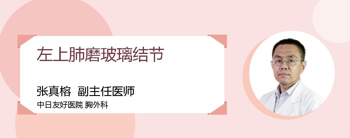 左上肺磨玻璃结节