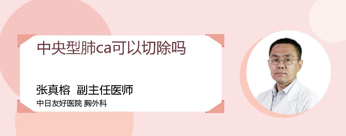 中央型肺ca可以切除吗