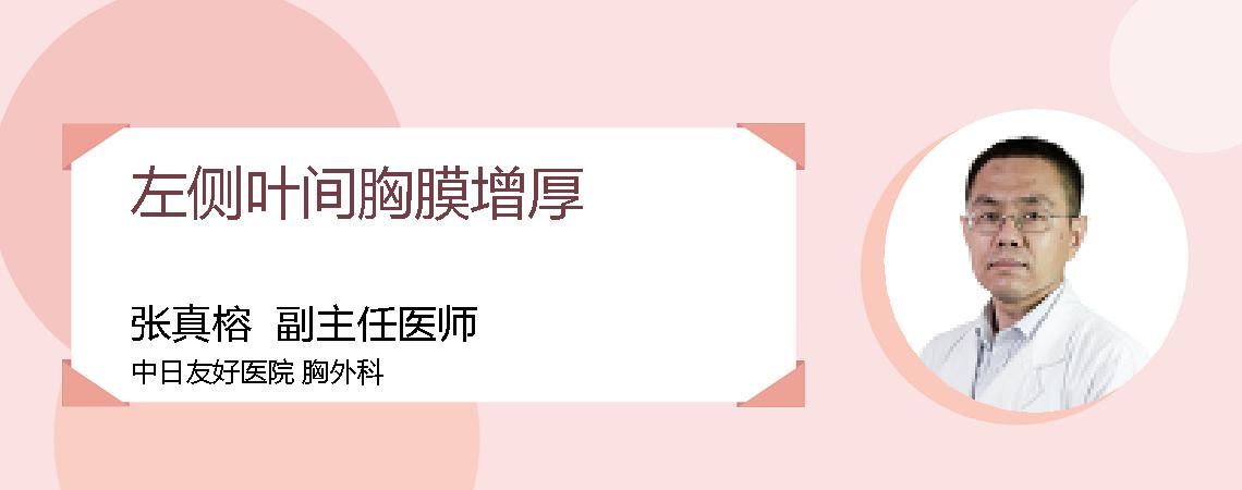 左侧叶间胸膜增厚