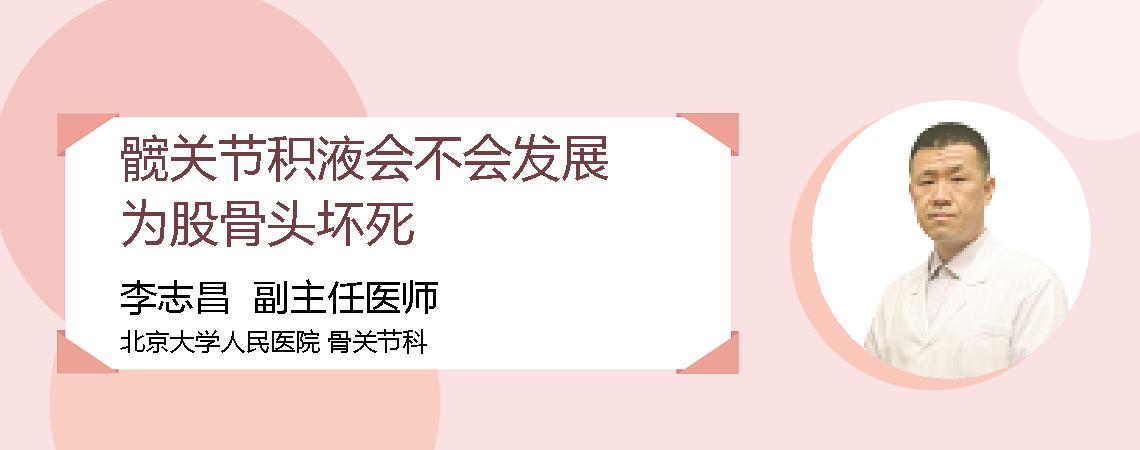 髋关节积液会不会发展为股骨头坏死