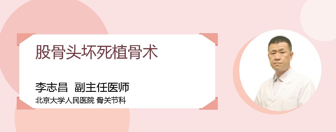 股骨头坏死植骨术
