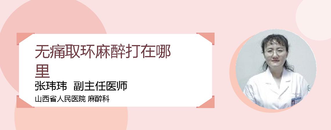 无痛取环麻醉打在哪里