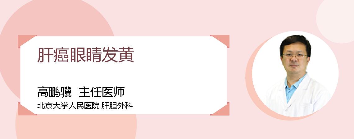 肝癌眼睛发黄