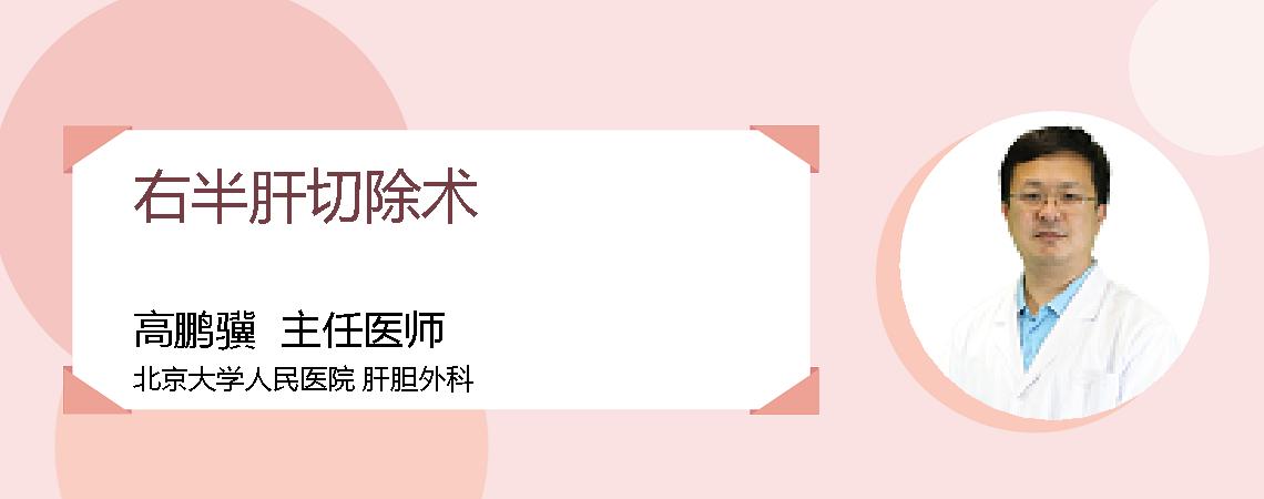 右半肝切除术