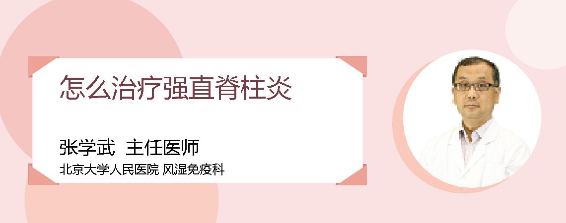 怎么治疗强直脊柱炎